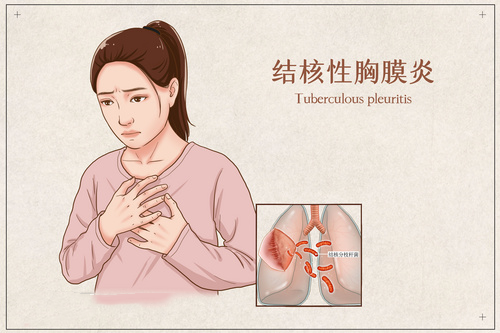 为什么对结核性胸膜炎病人要及时抽胸水治疗?