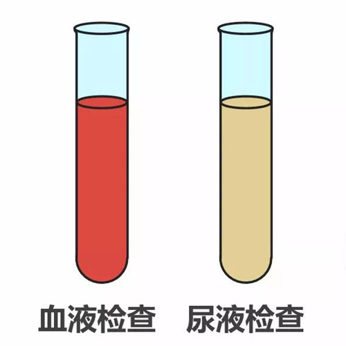 如何采集血液标本?